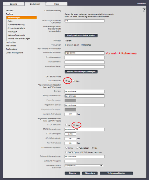 Gigaset C430A GO_Telekom_anonymous_DNS SRV.png